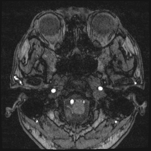 Click on the Serie image to view the images of VILLANUEVA, WILLIAM A.